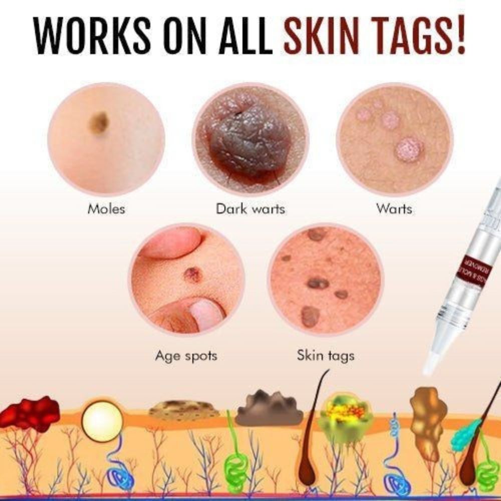 Skin Tag & Mole Care Applicator - At-Home Skin Care Tool