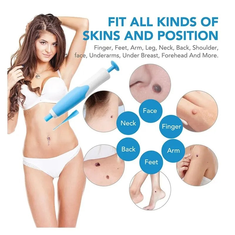 Skin Tag Care Kit - Gentle At-Home Applicator Bands