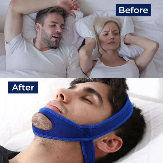 Chin Strap for Snoring - Adjustable Jaw Support Wrap