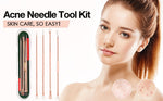 Blackhead & Pimple Extractor Kit - Stainless Steel Skincare Tools