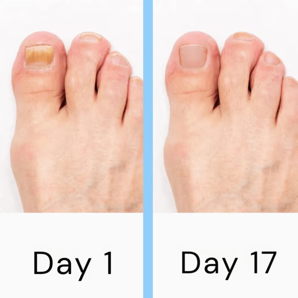 Nail Care Light Device - At-Home LED Nail Care Tool