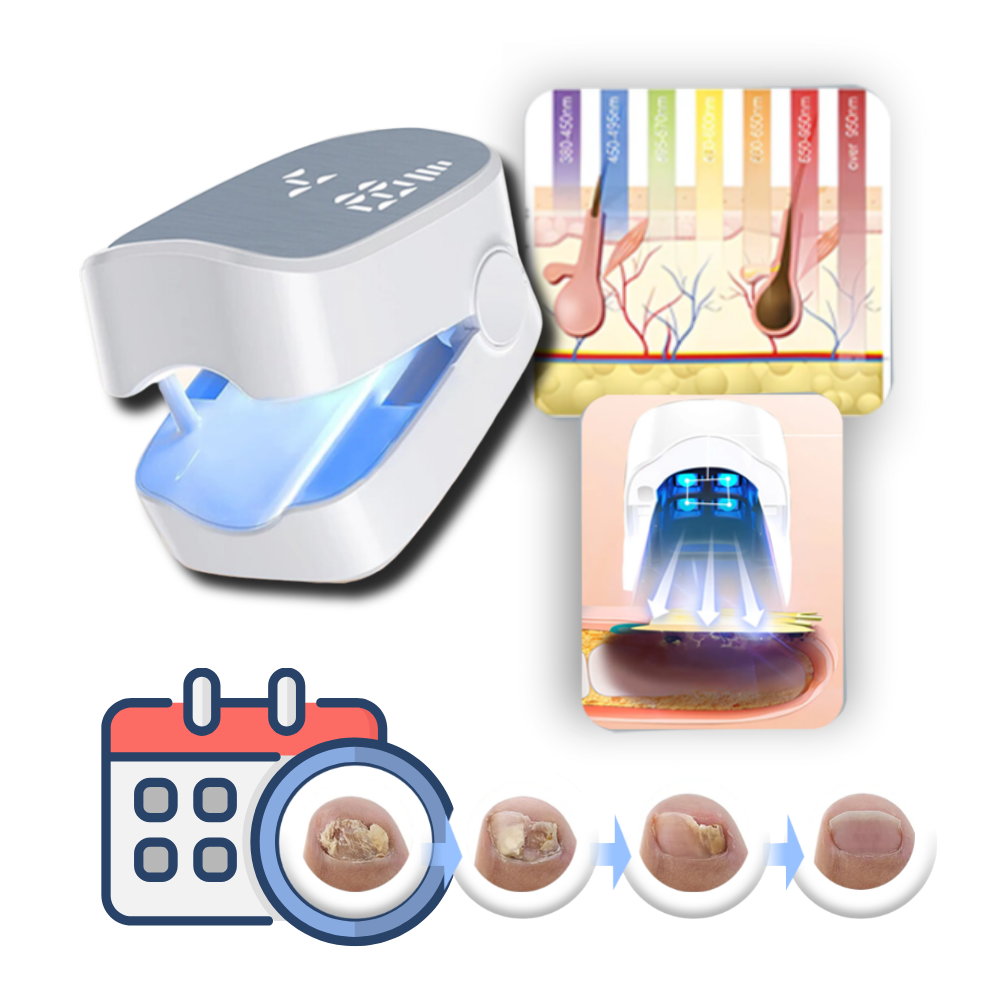 Portable Nail Care Laser Device - Painless At-Home Use